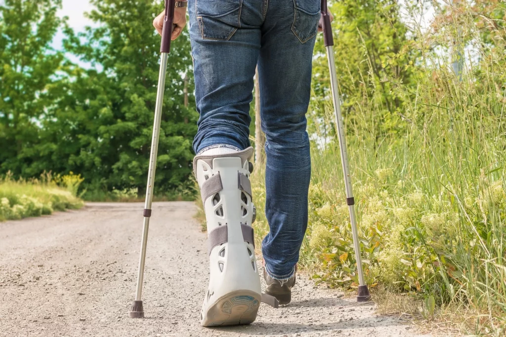 Person mit Krücken aufgrund eines gebrochenen Fußes