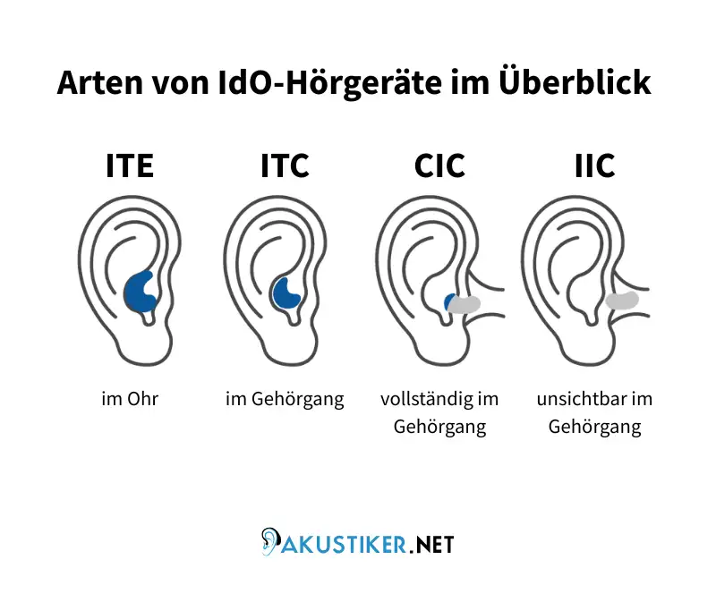 Infografik zu Arten von IdO-Hörgeräten im Überblick: ITE im Ohr, ITC im Gehörgang, CIC vollständig im Gehörgang und IIC unsichtbar im Gehörgang