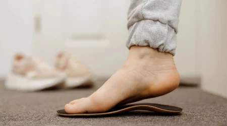 Ein Fuß auf einer othopädischen Einlage gegen Knick-Senkfüße