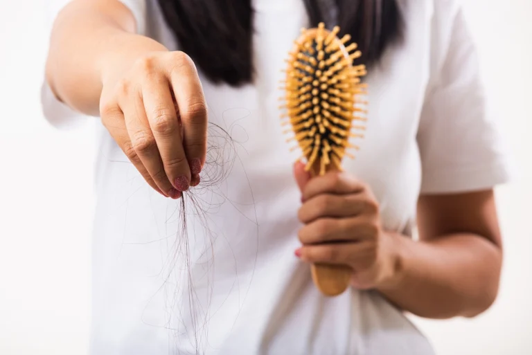 die ausgefallenen Haare, daneben eine Bürste, beides gezeigt von einer Frau